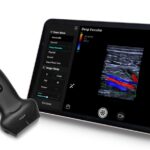 Mindray Launches New Wireless Handheld Ultrasound for Whole-Body Scanning