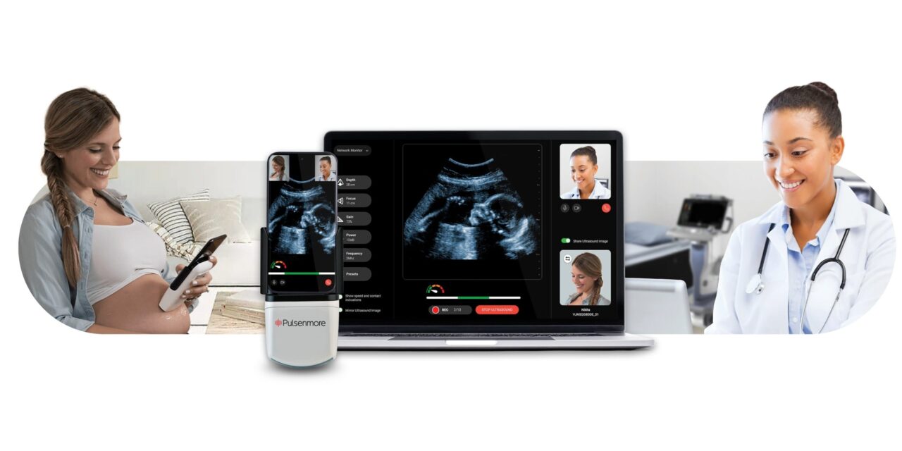 FDA Authorizes Home-Use Prenatal Ultrasound Device