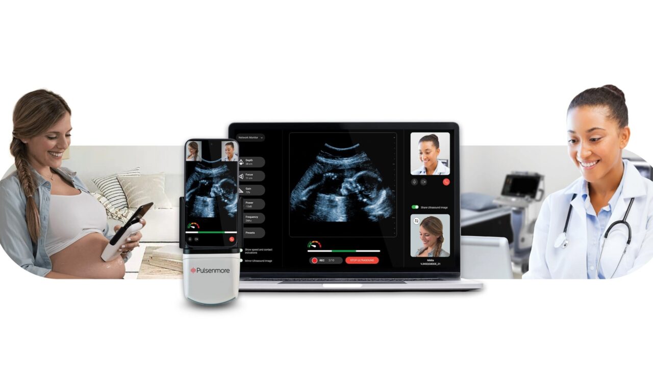 FDA Authorizes Home-Use Prenatal Ultrasound Device