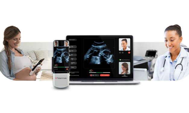 FDA Authorizes Home-Use Prenatal Ultrasound Device