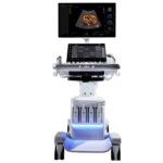 Samsung Introduces New R20 Ultrasound with AI Support and Improved Ergonomics