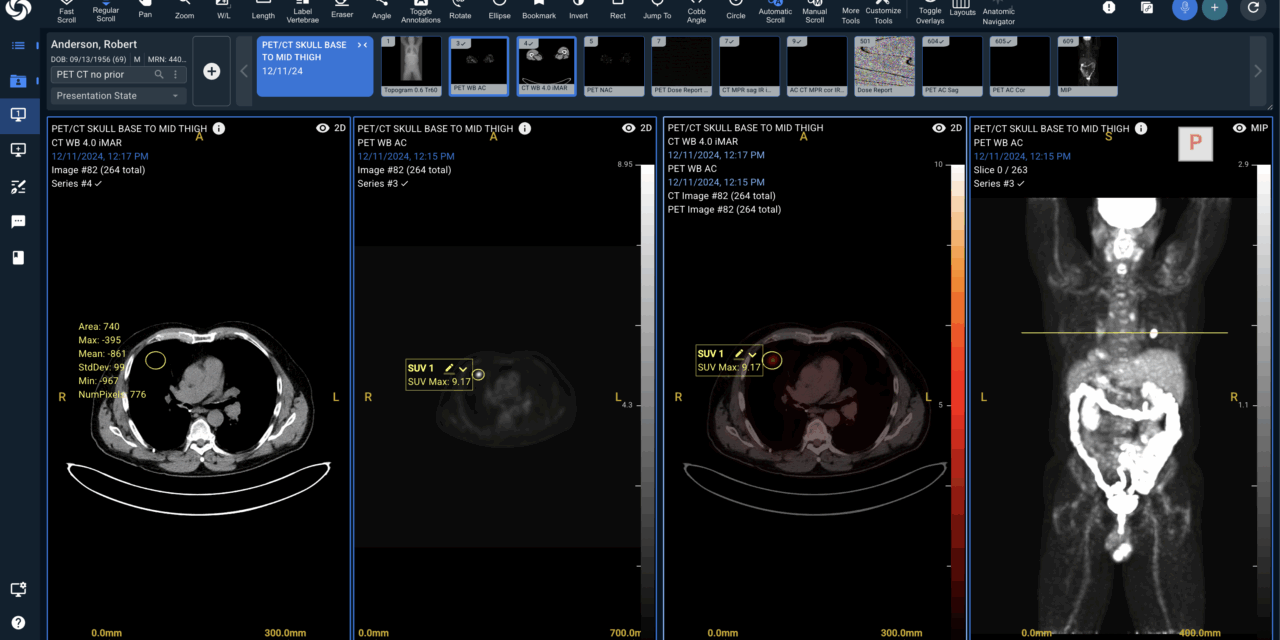 FDA Clears Sirona Cloud-Native Imaging Suite for PET-CT Support