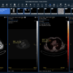 FDA Clears Sirona Cloud-Native Imaging Suite for PET-CT Support