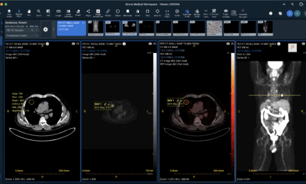 FDA Clears Sirona Cloud-Native Imaging Suite for PET-CT Support