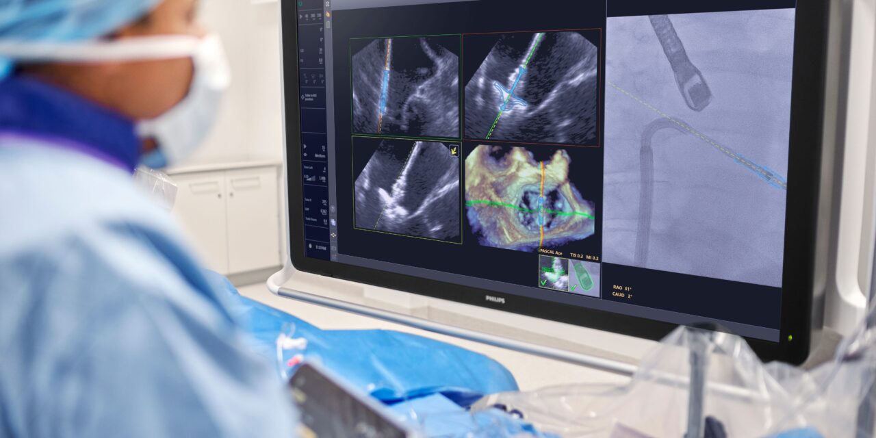 Philips Debuts AI Tool to Guide Mitral Valve Repair Devices in Real Time