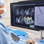 Philips Debuts AI Tool to Guide Mitral Valve Repair Devices in Real Time
