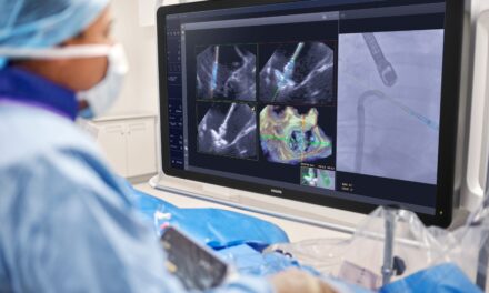 Philips Debuts AI Tool to Guide Mitral Valve Repair Devices in Real Time