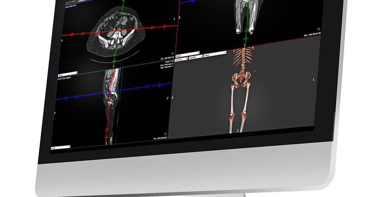 New Partnership Connects Radiology AI Operating System to Konica Minolta’s Exa Platform