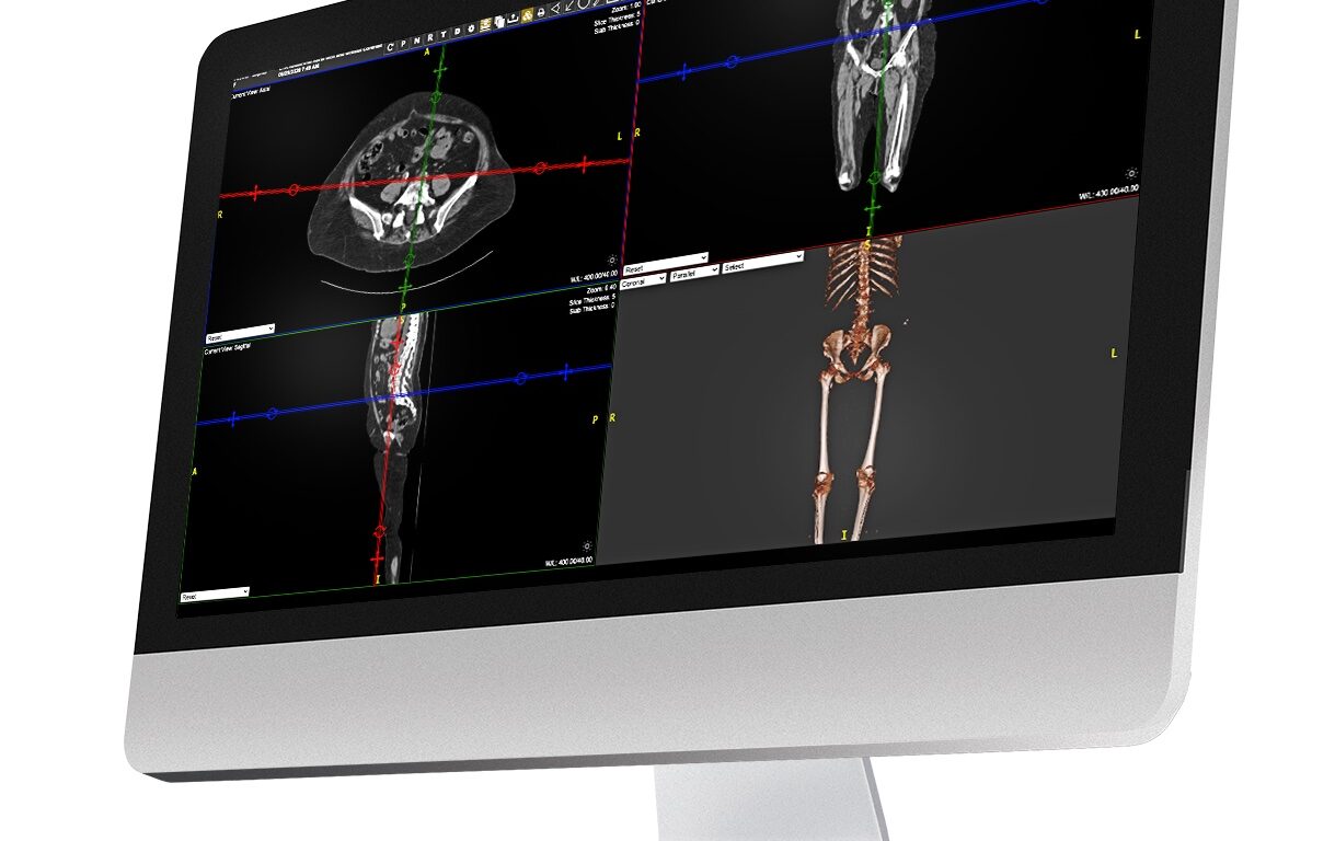 New Partnership Connects Radiology AI Operating System to Konica Minolta’s Exa Platform