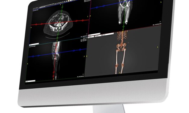 New Partnership Connects Radiology AI Operating System to Konica Minolta’s Exa Platform