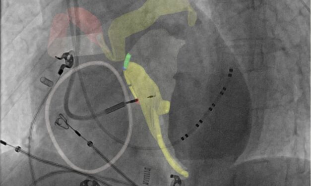 FDA Clears Platform for Noninvasive Cardiac Conduction System Visualization