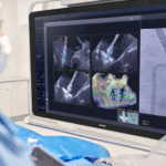 Philips Receives FDA Clearance for AI Software to Guide Mitral Valve Repair