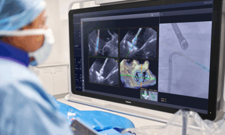 Philips Receives FDA Clearance for AI Software to Guide Mitral Valve Repair