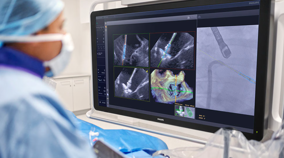 Philips Receives FDA Clearance for AI Software to Guide Mitral Valve Repair
