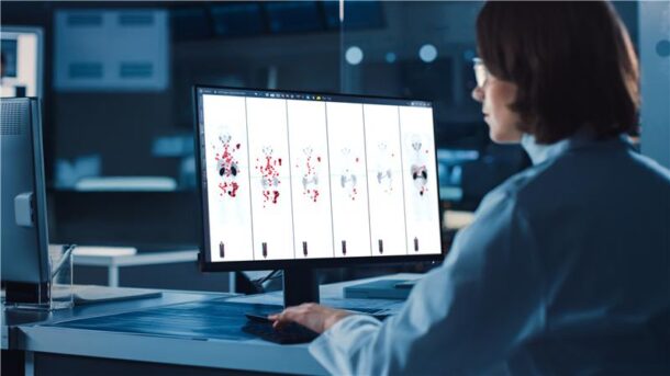 The AI-enabled software automates whole-body tumor burden analysis for PSMA PET/CT and SPECT/CT studies to help clinicians assess treatment eligibility and monitor response.