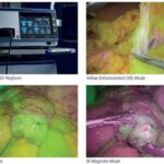 Olympus Launches Visera Elite III Surgical Imaging Platform in US