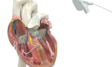 Defibrillation Lead Wins FDA Approval for Conduction System Pacing