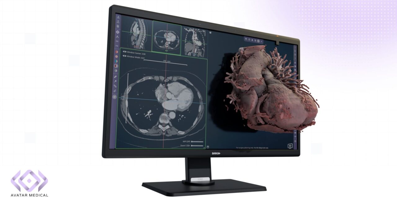 FDA Clears Avatar Medical Vision for 3D Imaging and Surgical Planning