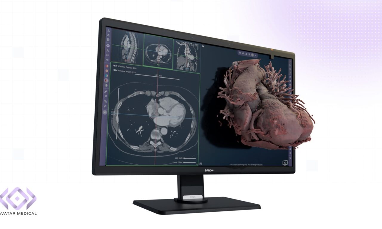 FDA Clears Avatar Medical Vision for 3D Imaging and Surgical Planning