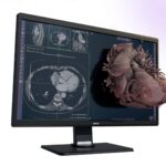 FDA Clears Avatar Medical Vision for 3D Imaging and Surgical Planning