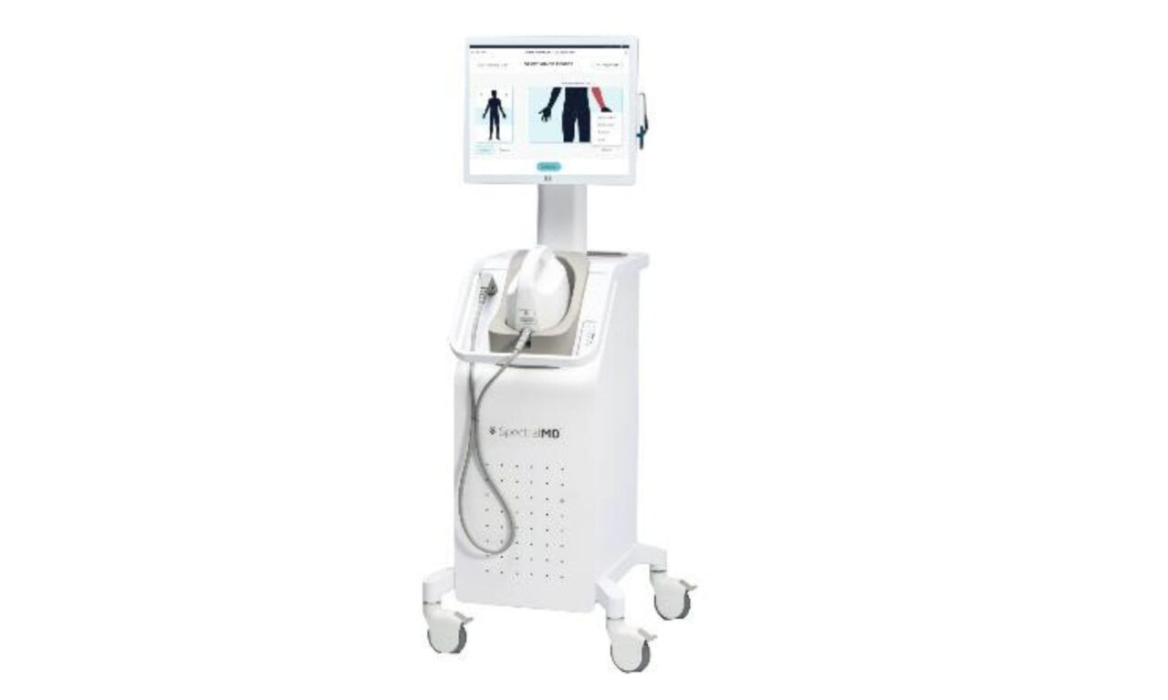 AI System for Predictive Burn Wound Assessment Receives FDA De Novo Clearance