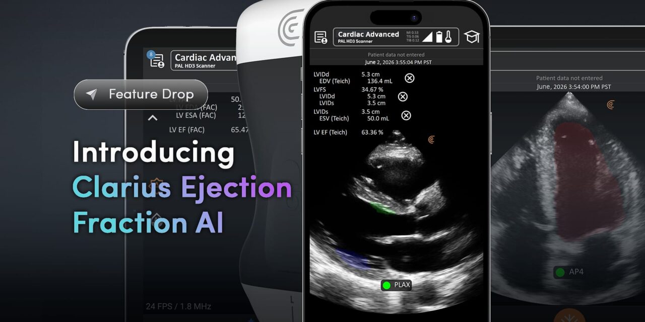 FDA Clears New AI Tool for Cardiac Ultrasound Assessments