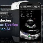 FDA Clears New AI Tool for Cardiac Ultrasound Assessments