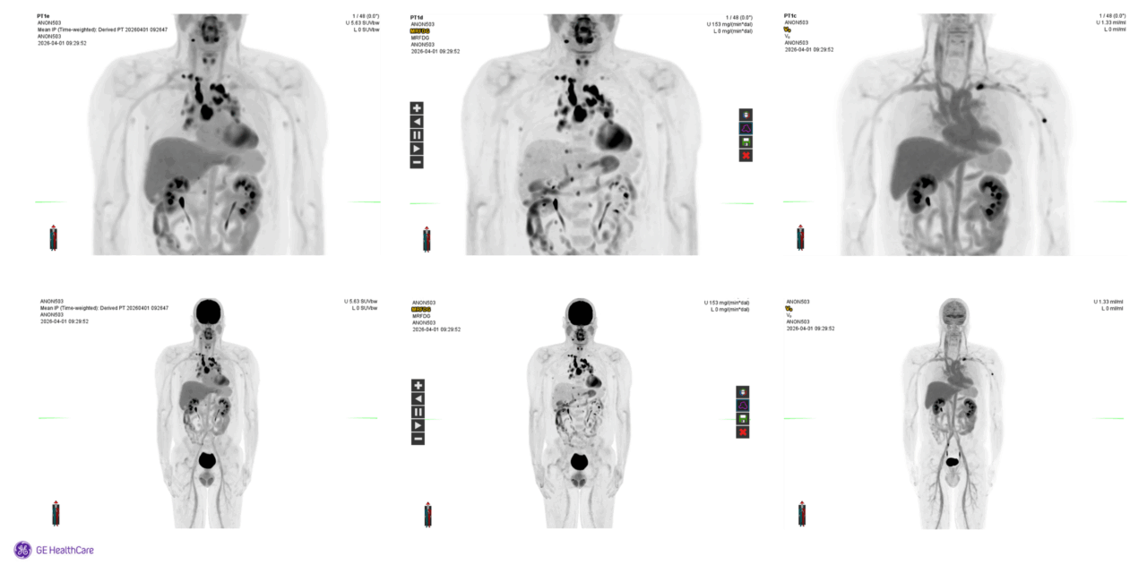 GE HealthCare Submits New PET Imaging Software for FDA Review