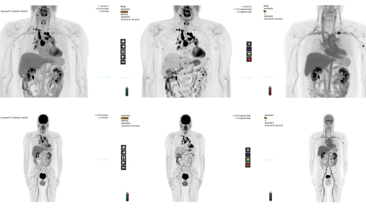 GE HealthCare Submits New PET Imaging Software for FDA Review