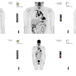 GE HealthCare Submits New PET Imaging Software for FDA Review