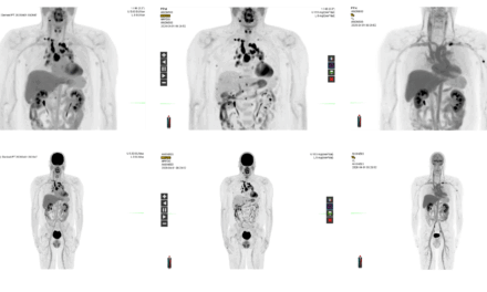 GE HealthCare Submits New PET Imaging Software for FDA Review