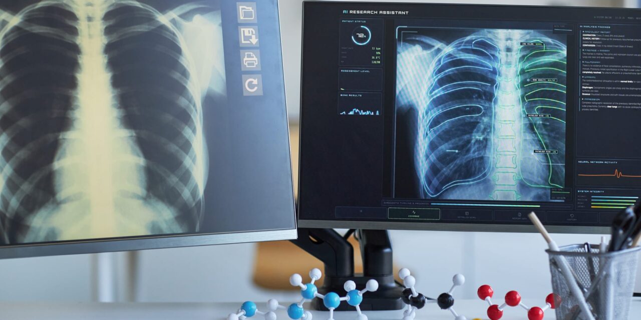 AI Tool for Drafting Radiology Reports Receives FDA Breakthrough Status