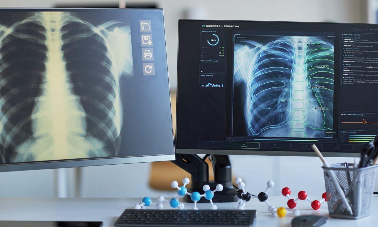 AI Tool for Drafting Radiology Reports Receives FDA Breakthrough Status