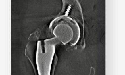 FDA Clears 3D Imaging Platform for Existing Surgical C-Arms