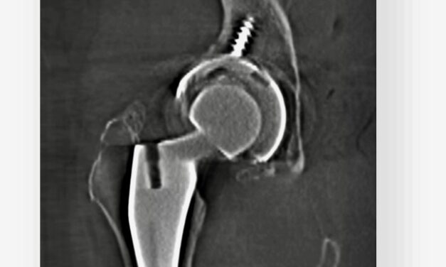 FDA Clears 3D Imaging Platform for Existing Surgical C-Arms