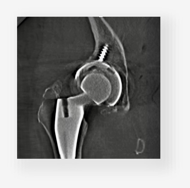 FDA Clears 3D Imaging Platform for Existing Surgical C-Arms