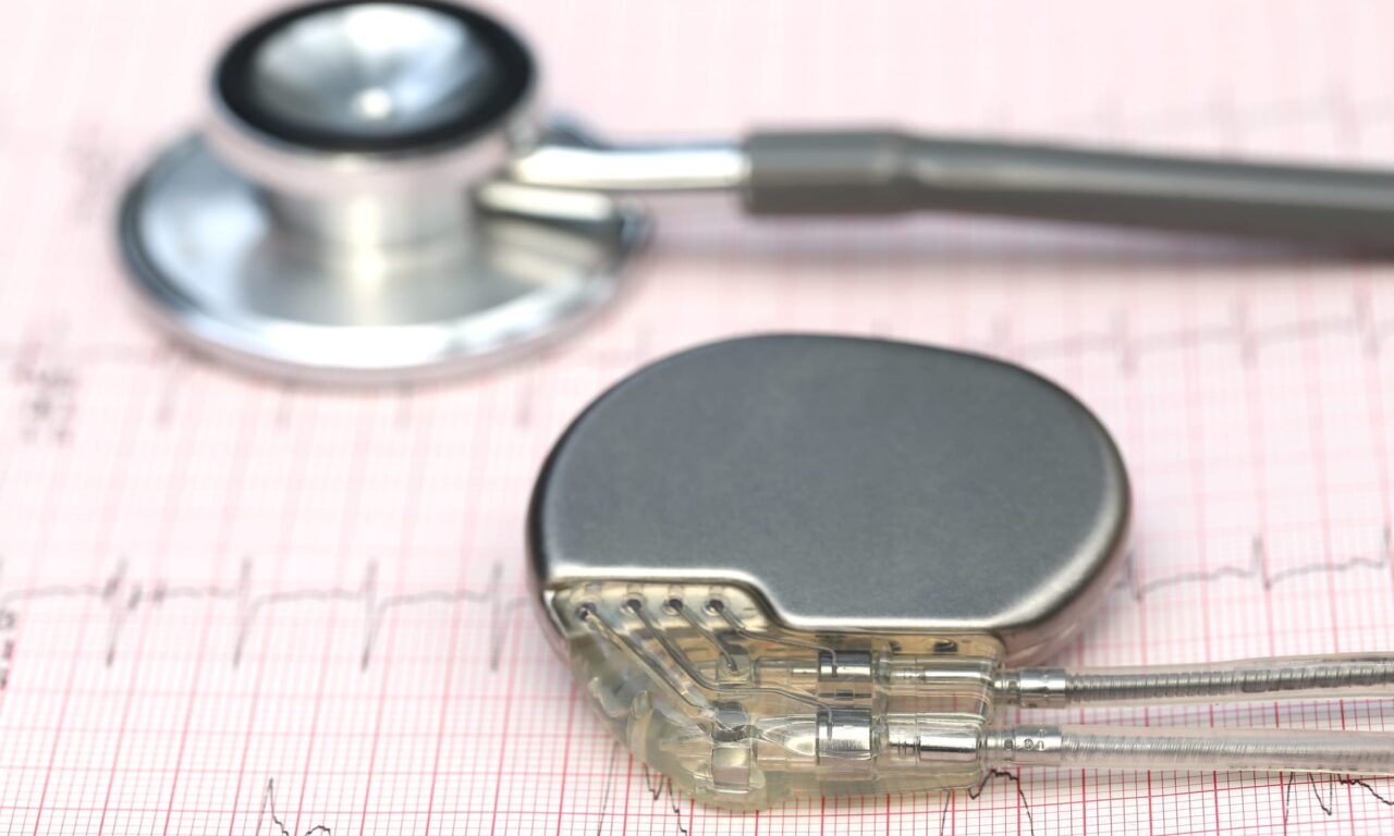 AAMI Releases Technical Report on Pacemaker Battery Longevity Management