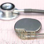 AAMI Releases Technical Report on Pacemaker Battery Longevity Management