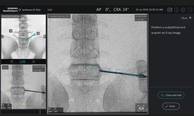 Siemens Healthineers Adds Spine Surgery Guidance Software to Mobile Imaging Systems