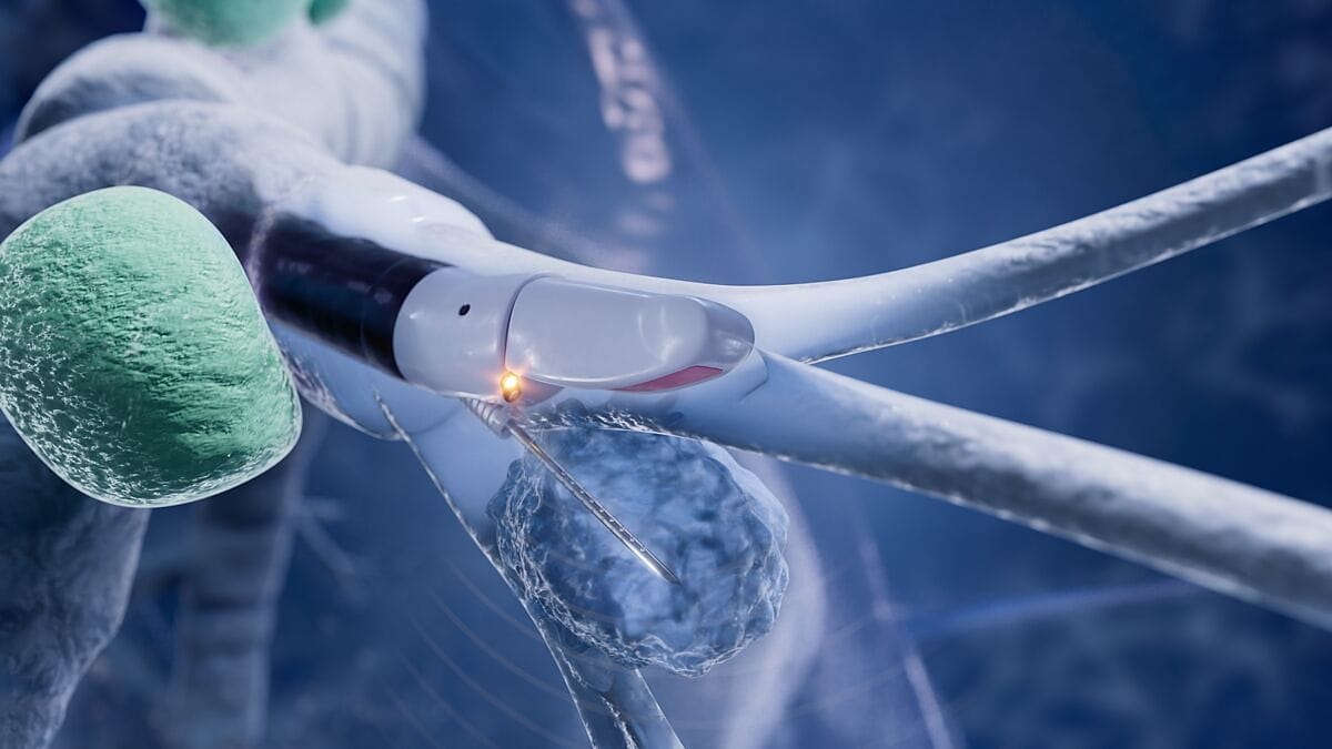 Olympus Launches Slimmer EBUS Bronchoscope for Deeper Lung Access